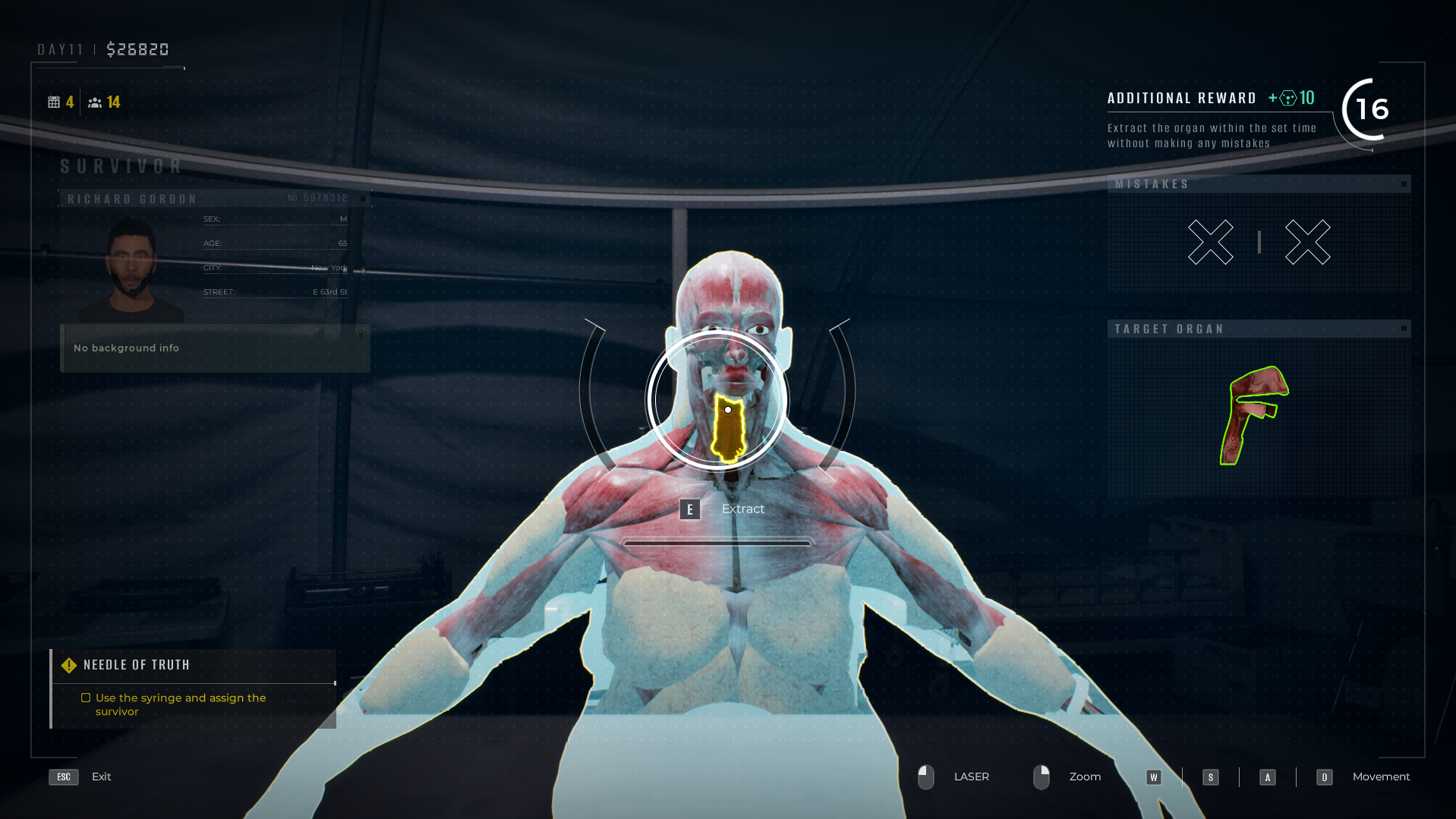 An X-ray view of a person standing, showing their internal organs and highlighting the larynx as to be removed.