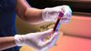 A lab technician holds a blood test.