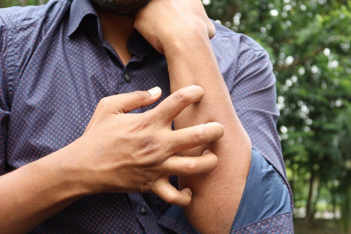 Science figures out why we know when to stop scratching an itch