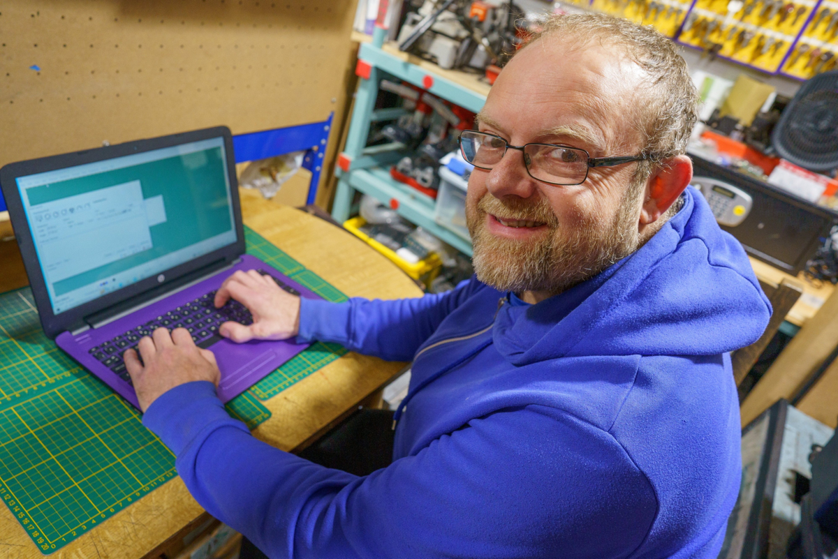 Cobbler who accidentally cut off thumb gets it replaced with his big toe
