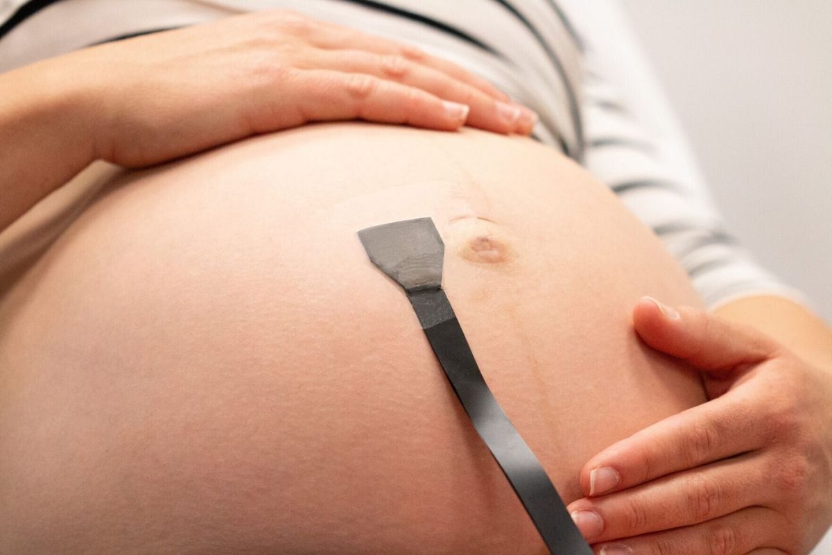 New tech offers 24/7 monitoring for high-risk pregnancies