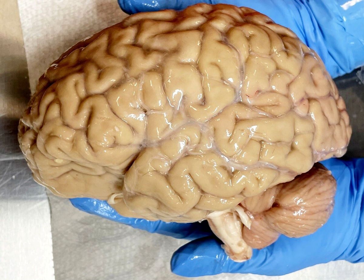 Would deep freezing humans like in sci-fi actually work?