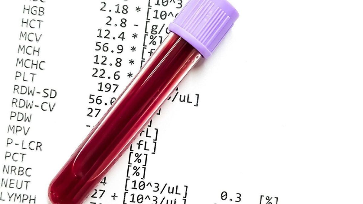 No test can confirm perimenopause. Doctors say you should get one anyway