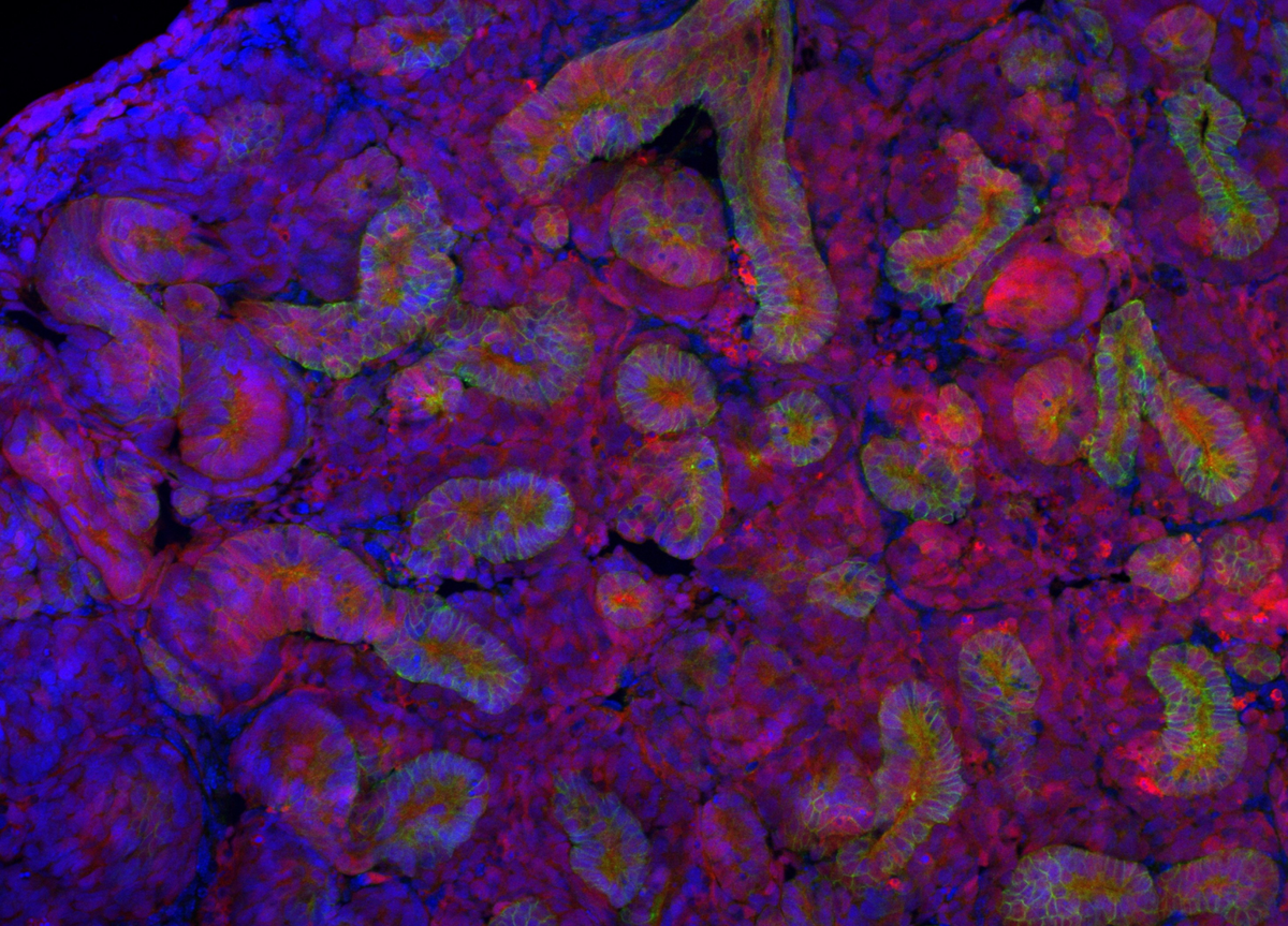 Rat kidneys grown in mice offer new hope for transplant patients