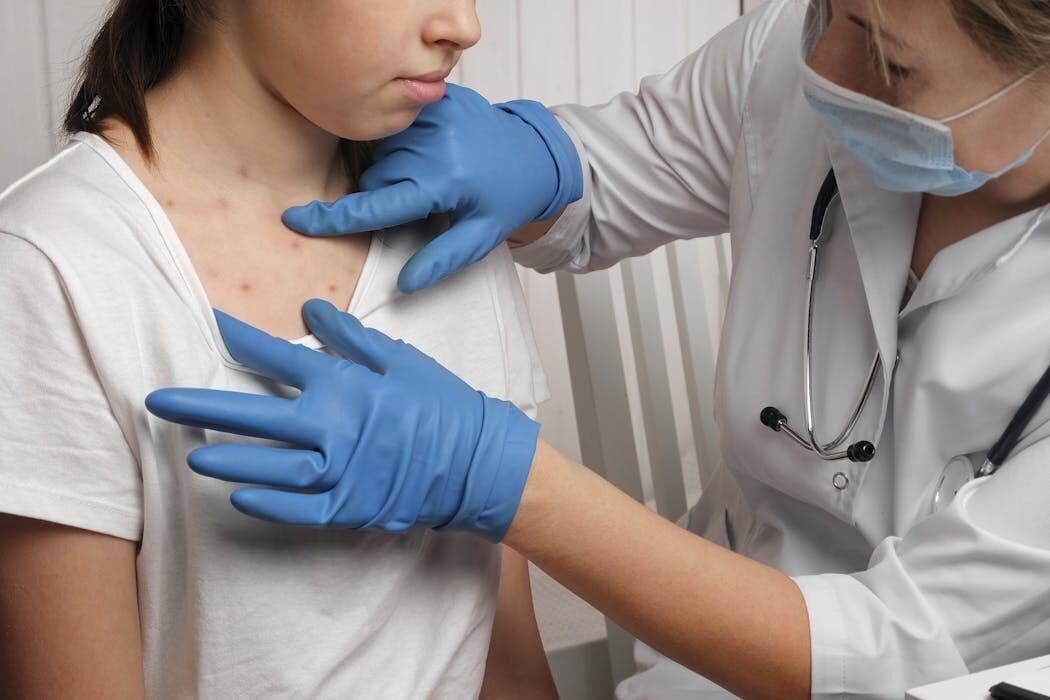 We study pandemics, and the resurgence of measles is a grim sign of what’s coming