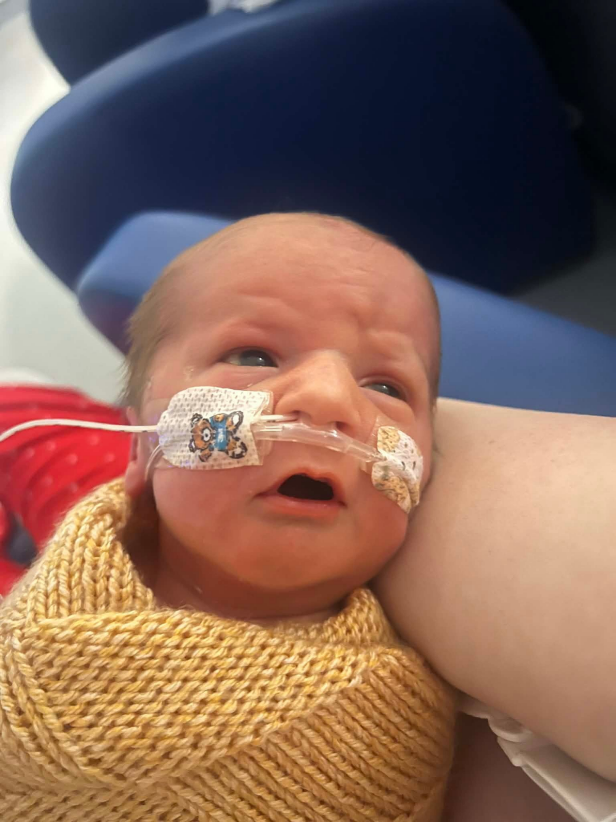 Miracle baby with ultra rare genetic disorder defies odds