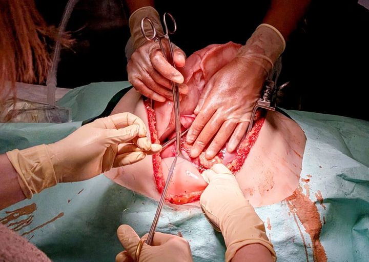 New 3D-printed ‘bleeding’ torsos used to train trauma surgeons