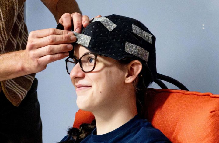 Wearing ‘cooling cap’ for 30 minutes can reduce depression symptoms