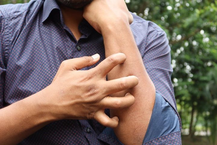 Science figures out why we know when to stop scratching an itch