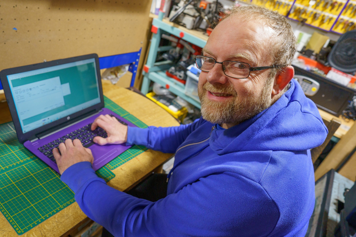 Cobbler who accidentally cut off thumb gets it replaced with his big toe