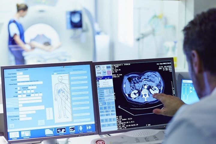 Millions of CT scans are done every year – most leave important data behind