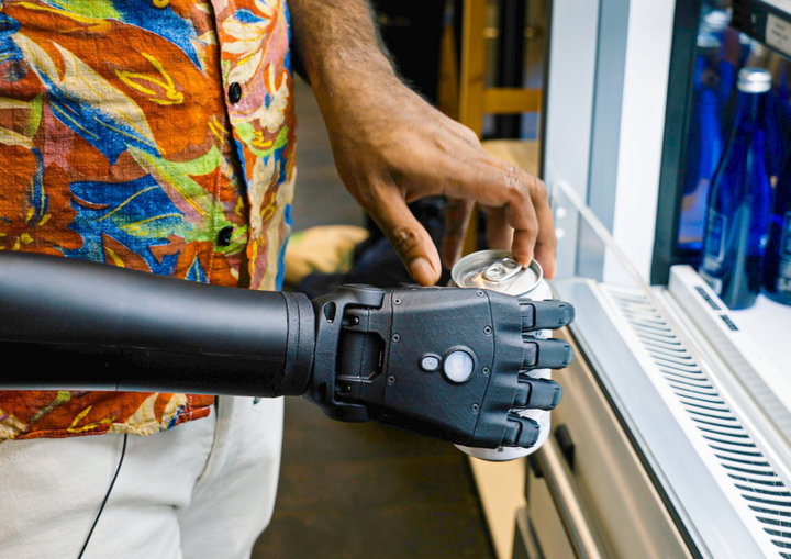 Amputee gets world’s first whole 3D bionic arm