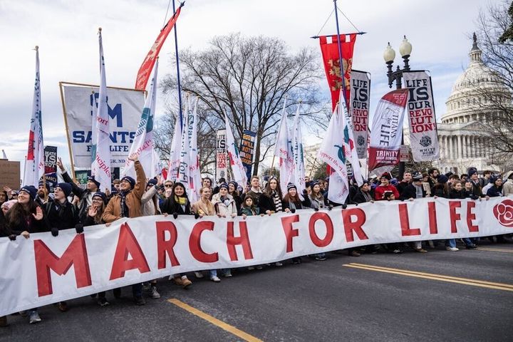 Abortion laws show that public policy doesn’t always line up with public opinion