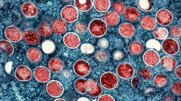 Montana researchers accused of smuggling Monkeypox into the U.S. from the Republic of Congo