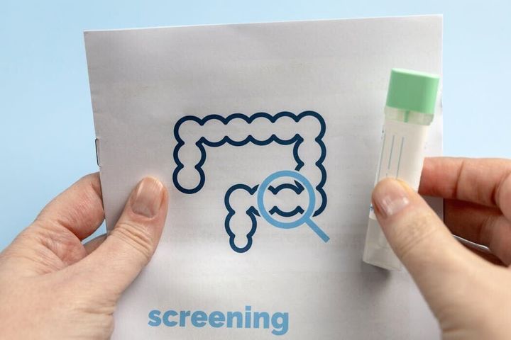Poop tests and blood tests join colonoscopy as options for colorectal cancer screening