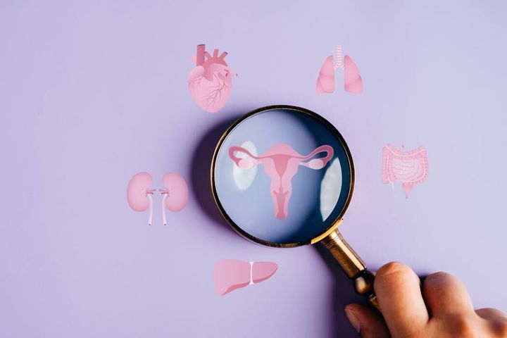 I’m a doctor who helped rename PCOS to PMOS – a 10-year process of listening to 14,000 patients and health professionals speak on how to improve care