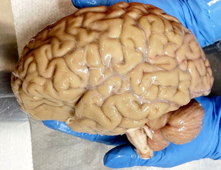 Would deep freezing humans like in sci-fi actually work?