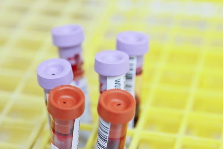 New test helps predict when Alzheimer’s symptoms start