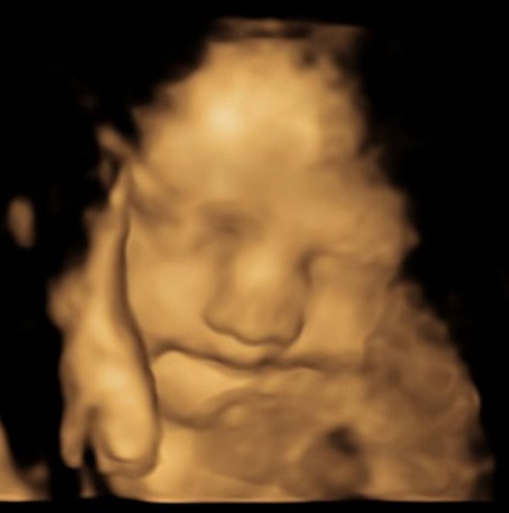Toddlers can remember smells from the womb