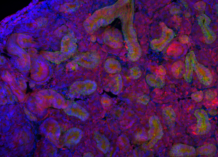 Rat kidneys grown in mice offer new hope for transplant patients