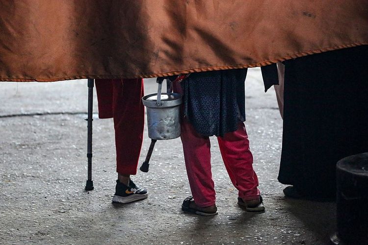 A photo of the legs of two children, one of them an above-knee amputee, as they stand behind a rusty-coloured drape.