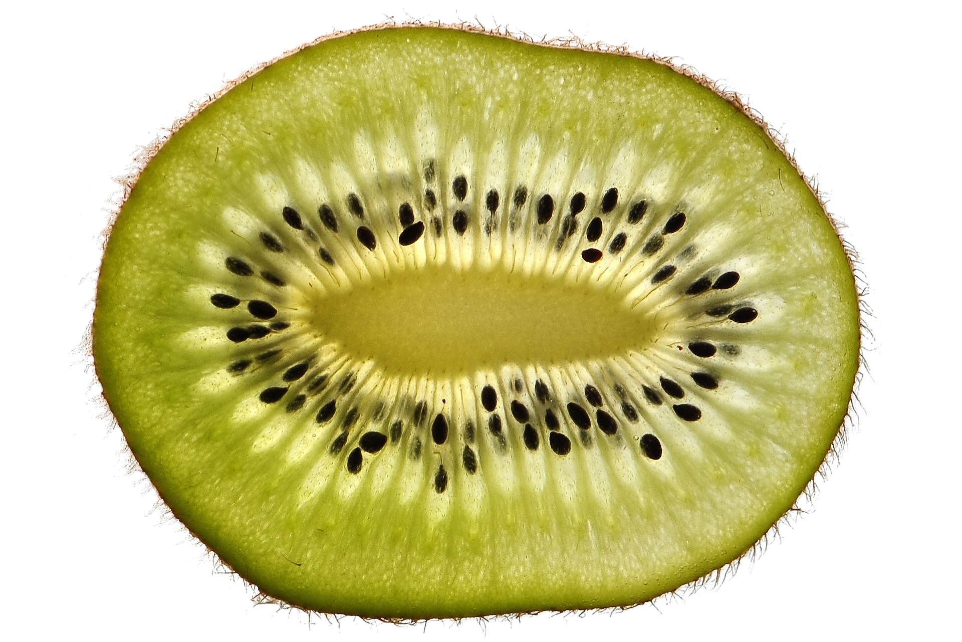 cross section of a kiwi fruit
