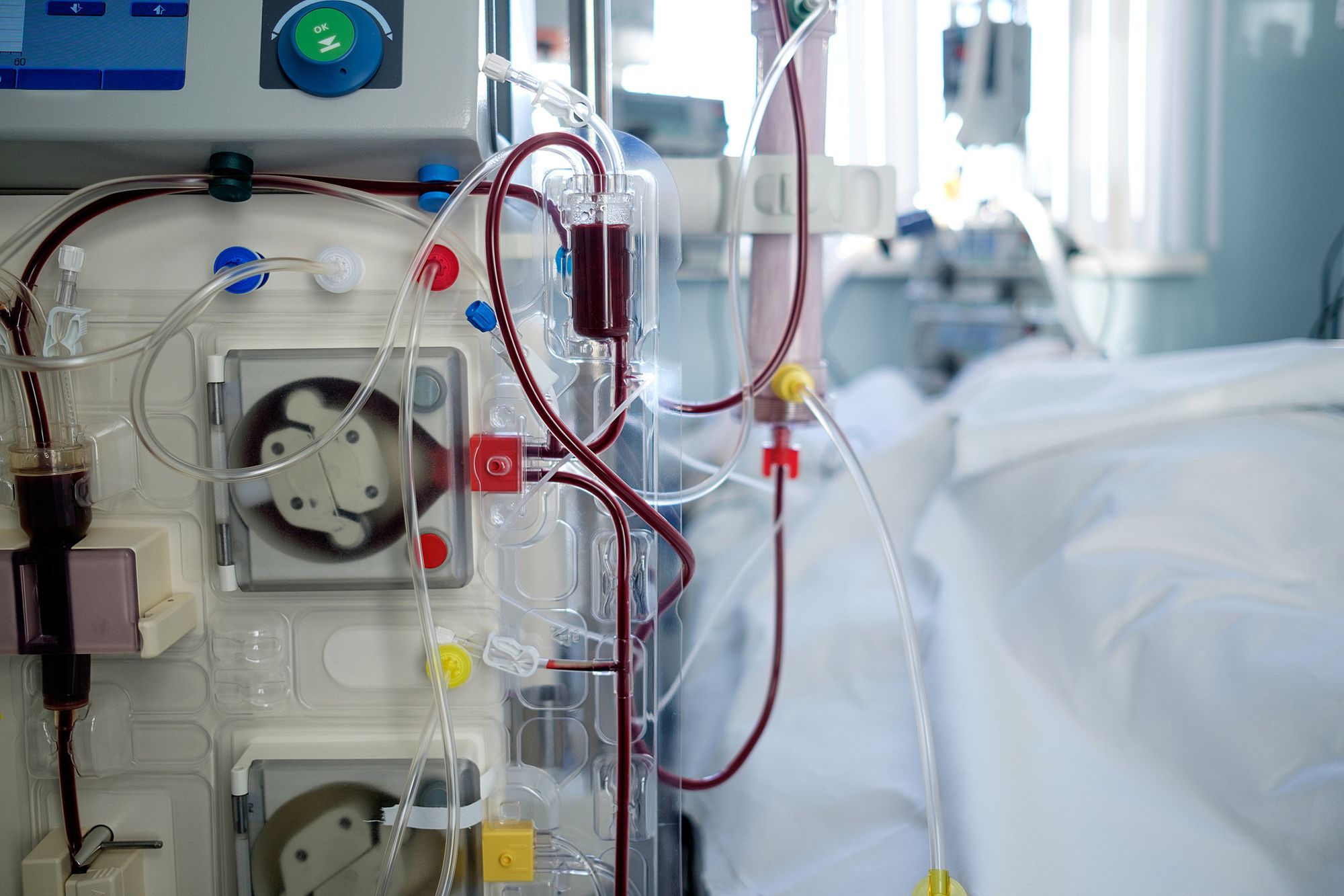 Luta de quem tem no transplante uma nova chance para viver foi impactada na pandemia