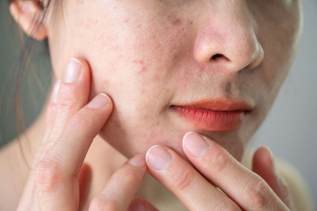 Un Viaje a Través de la Dermatología con Saúl: Lecciones y Reflexiones