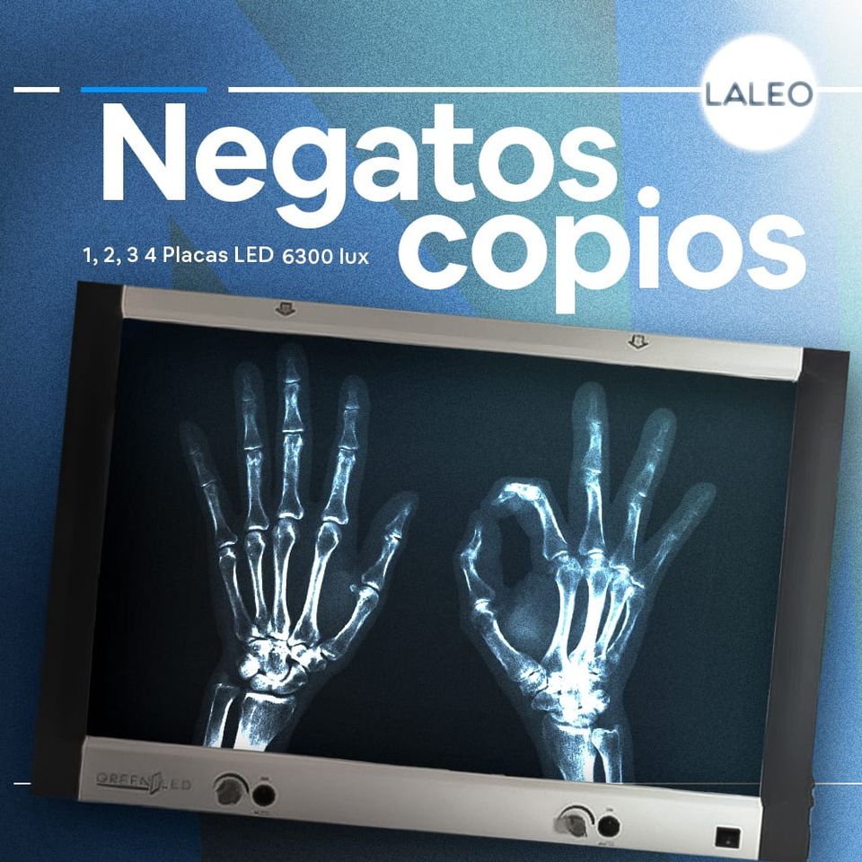 Historia del Negatoscopio: De las Lámparas Fluorescentes a la Revolución LED