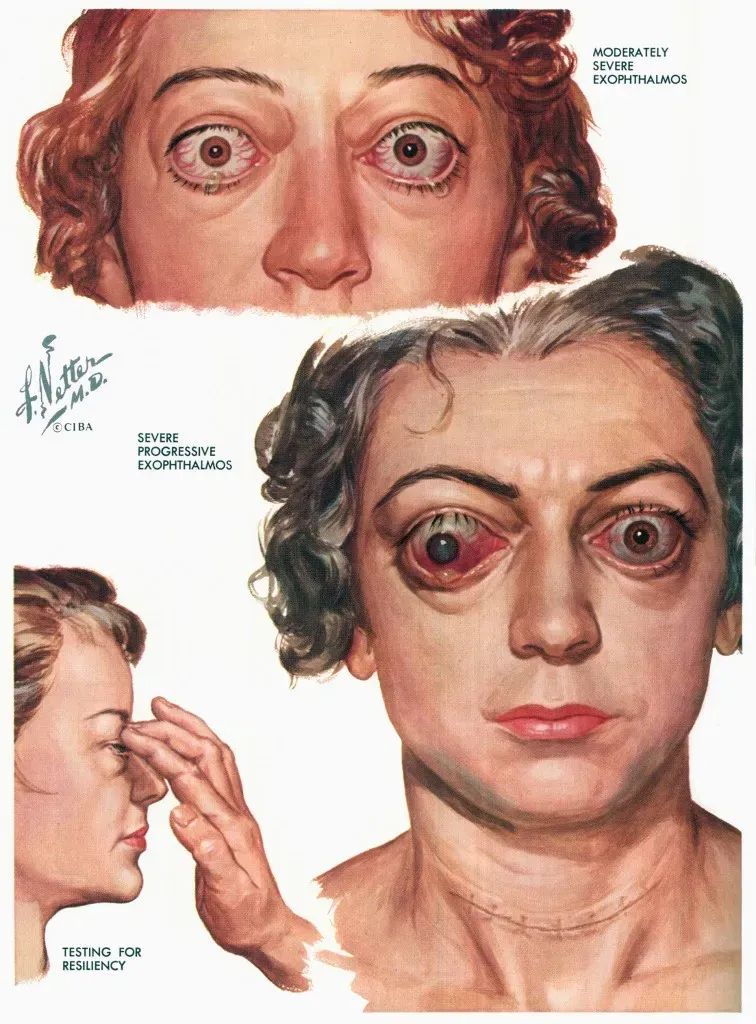 Frank Netter: El médico que dibujó el cuerpo humano para el mundo