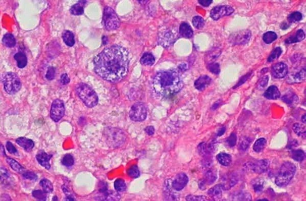 Learning Beyond Limits: Open Source Collaboration in the Classroom