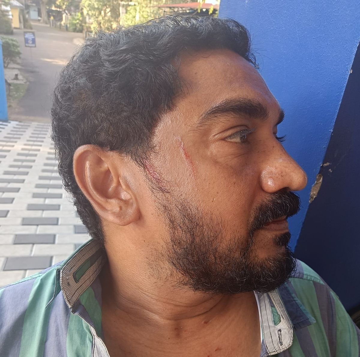 സർവ്വീസ് സഹകരണ ബാങ്കിൽ എത്തിയ മൂന്നംഗ സംഘം അസി. സെക്രട്ടറിയെ മർദ്ദിച്ചതായി പരാതി