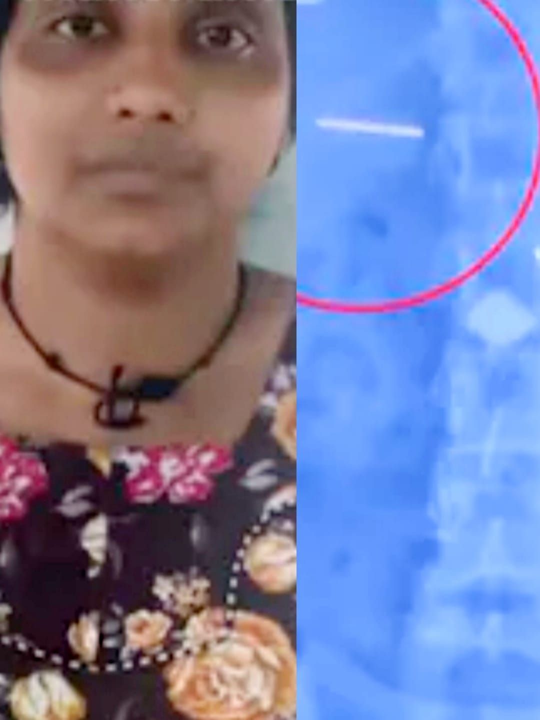 സ്വർണമാല മോഷ്ടിച്ചു വിഴുങ്ങിയ സ്ത്രീയെ പോലിസ് അറസ്‌റ്റ് ചെയ്തു