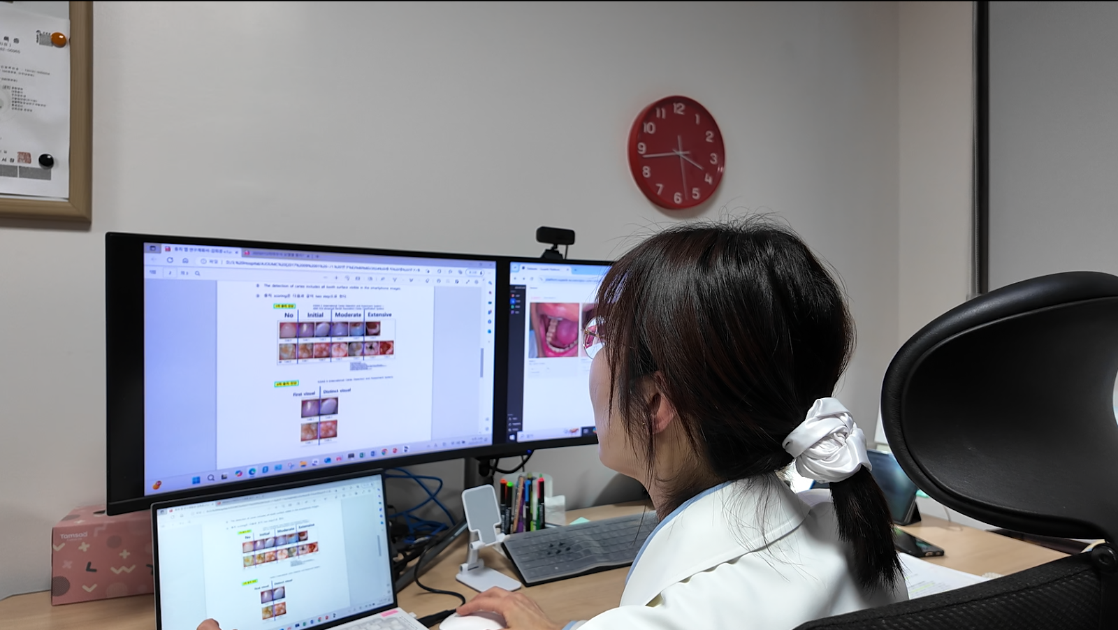 충치 진단 AI – 철저한 보안과 라벨링 자동화로 3주 만에 빠르게 첫 모델 완성