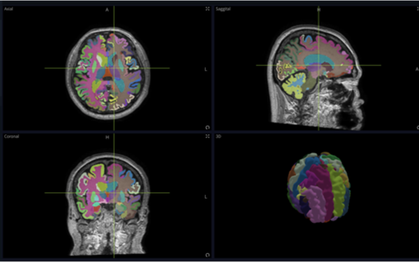 AI는 의료 진단에 어떻게 사용될까?: 의료진의 제 3의 눈과 귀