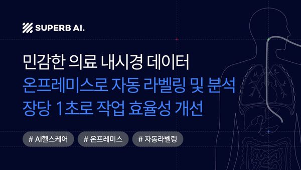 AI 기반 내시경 종양 분석: N 의료 연구기관의 성공 사례