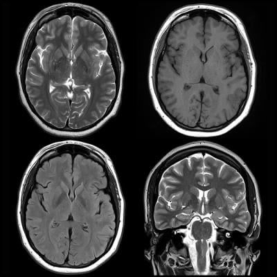 Featured image is from January 2, 2018 — “Information from brain magnetic resonance images (MRIs) can help identify people wi