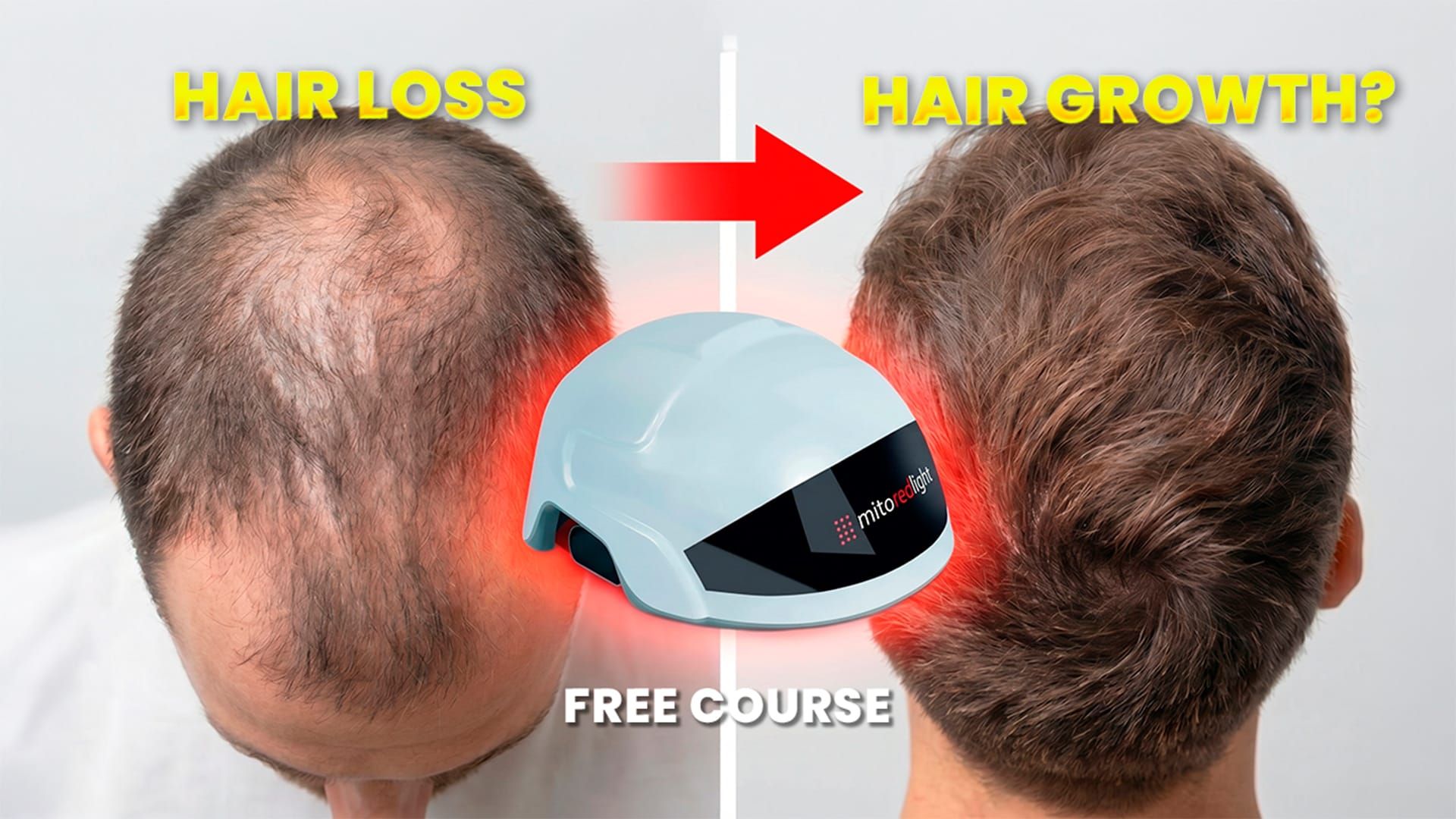 Red Light Therapy For Hair Loss: EVERYTHING You Need To Know