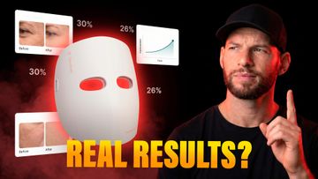 Do LED Face Masks Work? Real Before & After Evidence