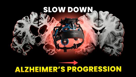 THIS Device Counters MCI/Alzheimer - Here’s The Data
