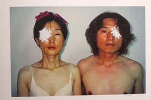 A printed photograph of two mostly-nude people from the chest up, looking toward the camera. They are standing side by side. Each has one eye bandaged (opposite of the other).