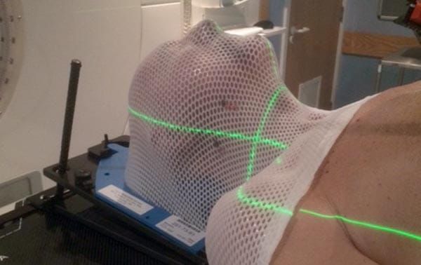 November is mouth cancer month