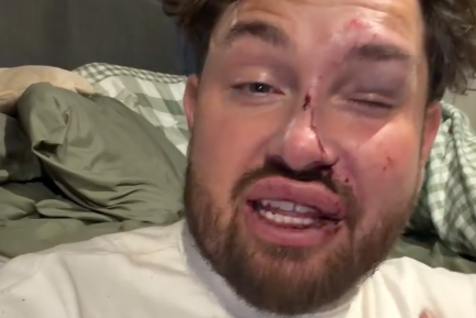 MAFS star Mark Kiley victim of brutal attack