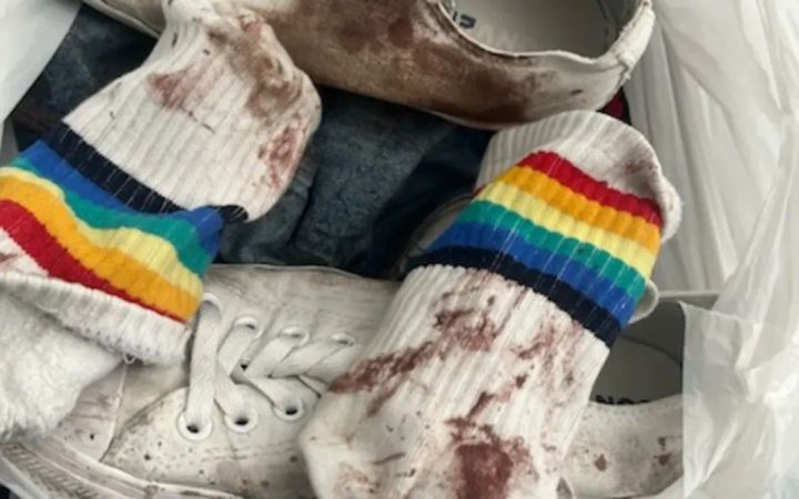 *GRAPHIC CONTENT*: Gay man violently attacked in New Zealand