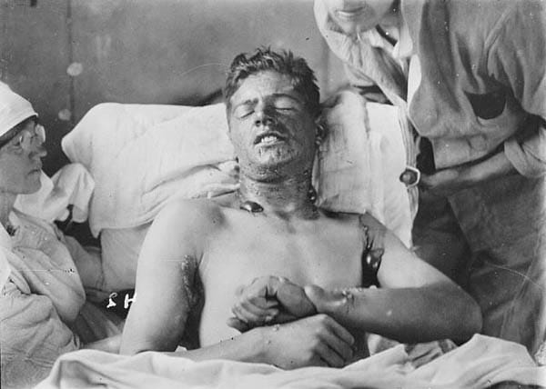 World War One Photos