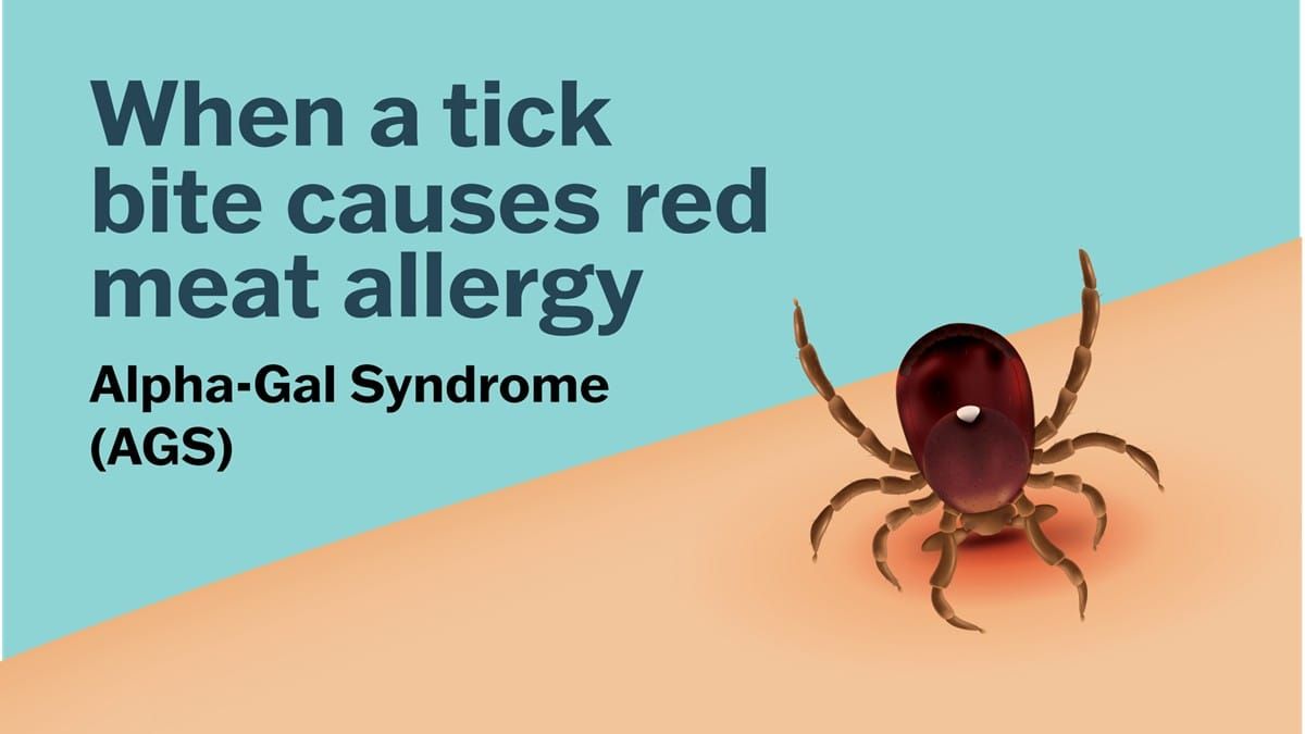 Does The Alpha-Gal Syndrome explosion show signs of a man-made operation?
