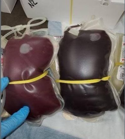 New Study Shows Patients Refusing Transfusions From modRNA Blood Supply