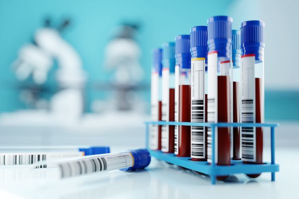 Rack of vials of blood for testing with two empty vials in the foreground and microscopes in background.