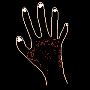 Bleeding Burning Knuckles