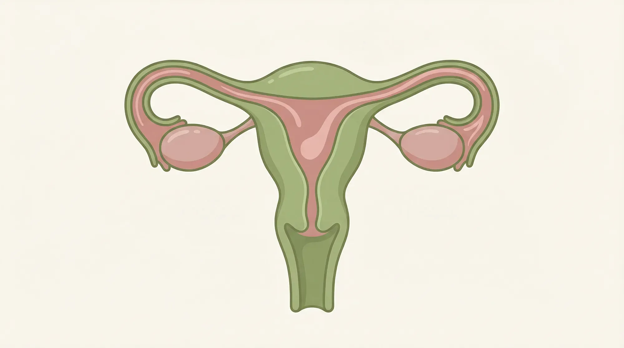 Medical illustration of HSG procedure showing contrast dye flowing through fallopian tubes